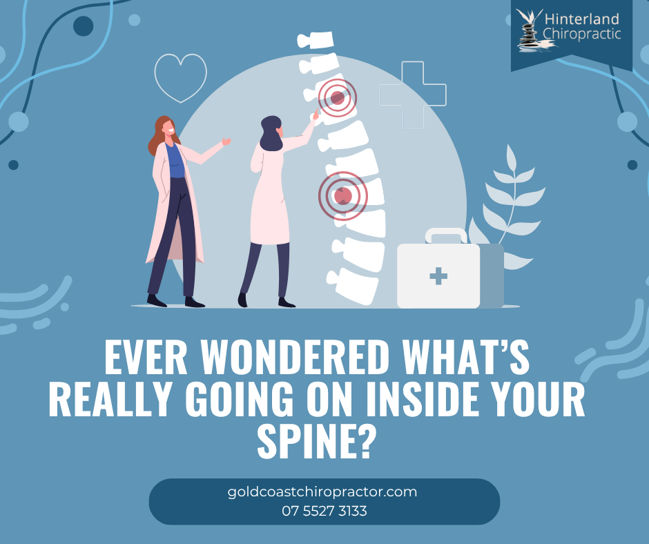 Ever wondered what’s really going on inside your spine? | Gold Coast Chiropractic Treatment